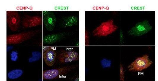 CENP-Q antibody