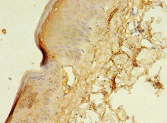 CENPB Antibody