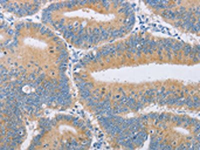 CENPE Antibody