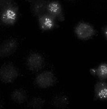 CENPE Monoclonal Antibody [1H12] - Unconjugated / 0.1ml