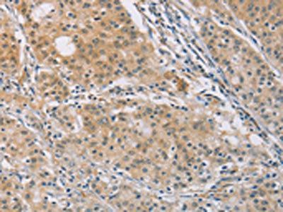 CENPF Antibody