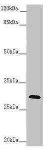 CENPH Antibody