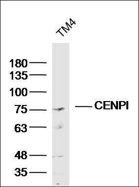 CENPI Rabbit Polyclonal Antibody