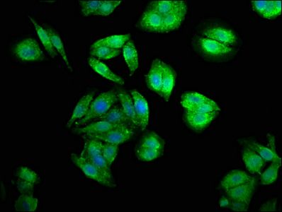CENPJ Antibody