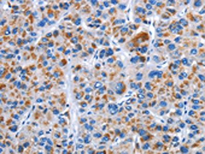 CENPJ Antibody
