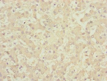 CENPK Antibody