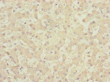 CENPK antibody