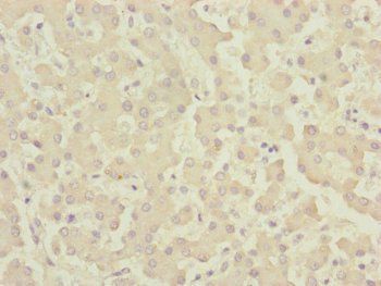 CENPK Antibody