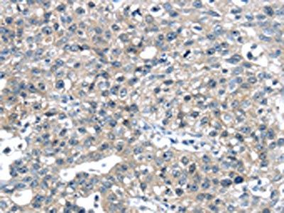 CENPM Antibody