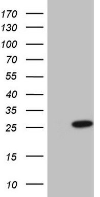 Centrin 1 (CETN1) antibody