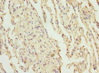 CEP120 antibody