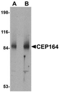 CEP164 Antibody