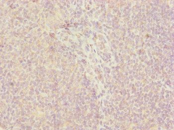 CEP57L1 Antibody