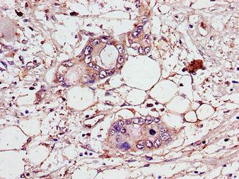 CEP70 Antibody
