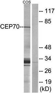 CEP70 antibody