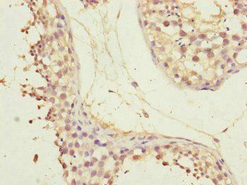 CEP72 antibody