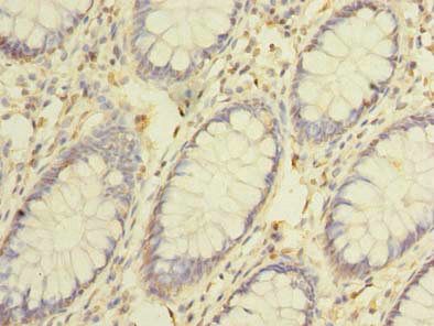 CEP76 Antibody
