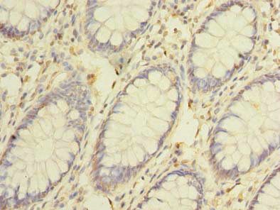 CEP76 antibody