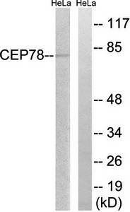 CEP78 Antibody