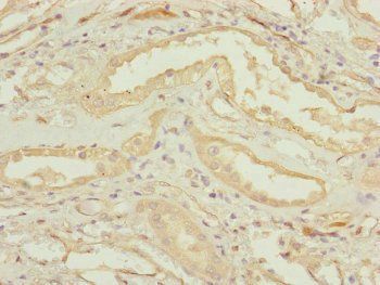 CEP83 antibody