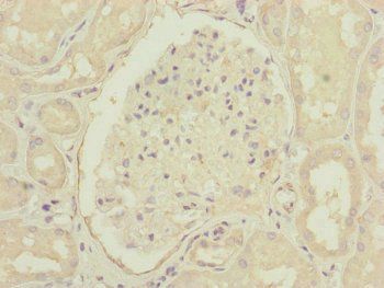 CEP83 Antibody
