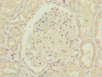 CEP83 antibody