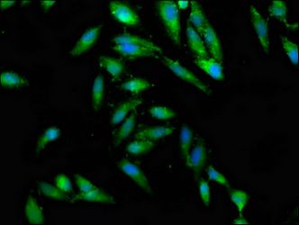 CEP97 antibody