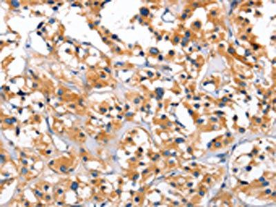 CEP97 Antibody