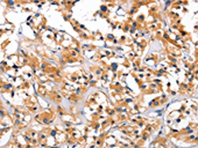 CEP97 antibody