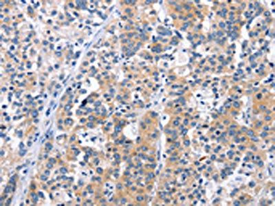 CEP97 antibody