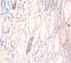 Cerebellar degeneration-related protein 2 antibody