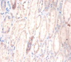 CDR2 Antibody