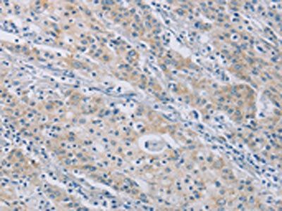 CERKL Antibody