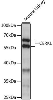 CERKL antibody