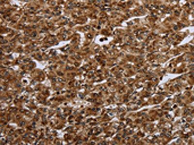 CERS1 Antibody