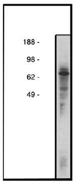Rabbit anti Human Ceramide Transfer Protein (CERTL)