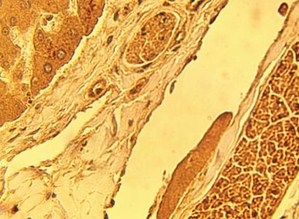 Rabbit anti Human Ceramide Transfer Protein (CERTL)