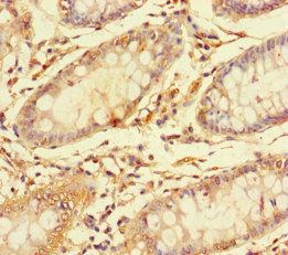 CES3 Antibody