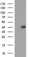 CESK1 (CCT8L2) antibody
