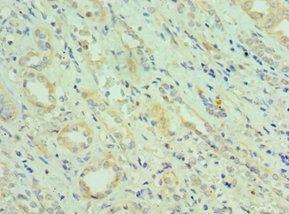 CETN2 Antibody