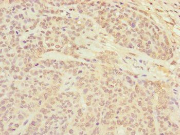 CETN3 Antibody