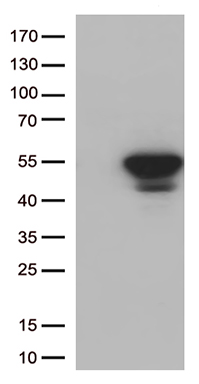 Cezanne (OTUD7B) antibody