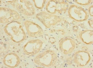 CFAP100 Antibody