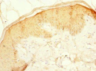 CFAP20 Antibody