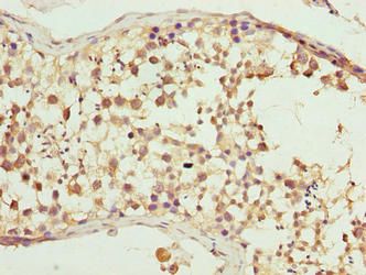 CFAP52 Antibody