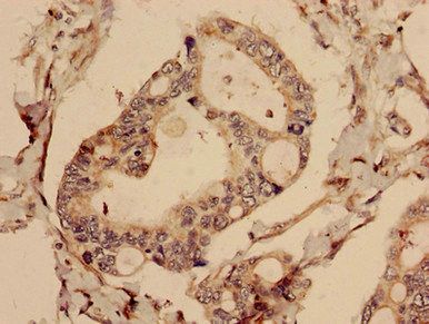 CFAP61 Antibody