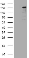 CFHL1 (CFHR1) antibody