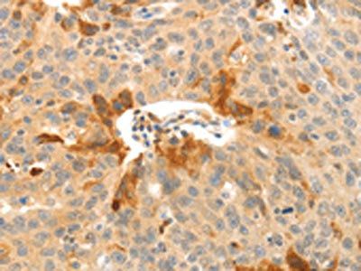 CFHR1 antibody