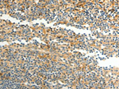 CFHR1 antibody