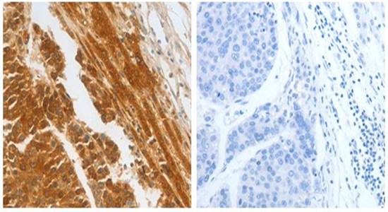 CFHR1 Antibody